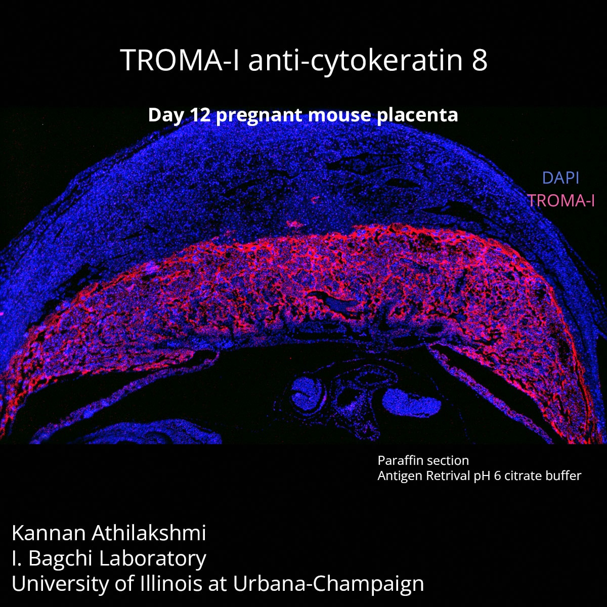 Krt8 Antibody (TROMA-I) - DSHB